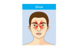 Sinus-Kopfschmerzen