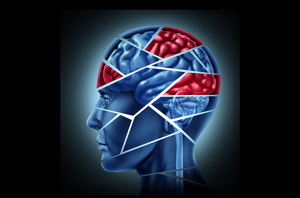 Die wichtigsten Informationen über Migräne-Kopfschmerz