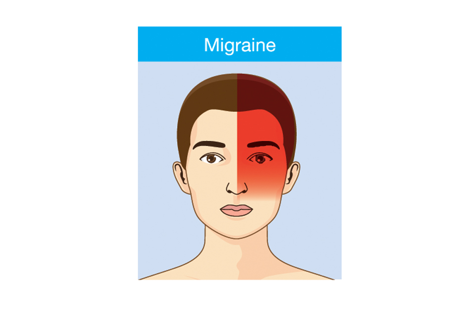 Migräne Kopfschmerzen