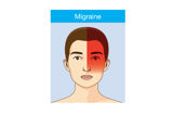 Migräne Kopfschmerzen